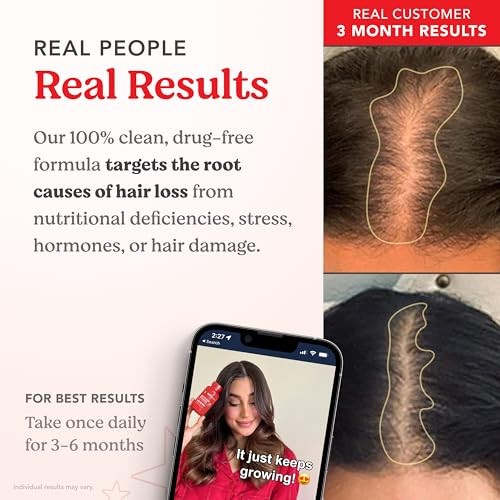 HAIRtamin Advanced Hair Growth Supplement for Women & Men