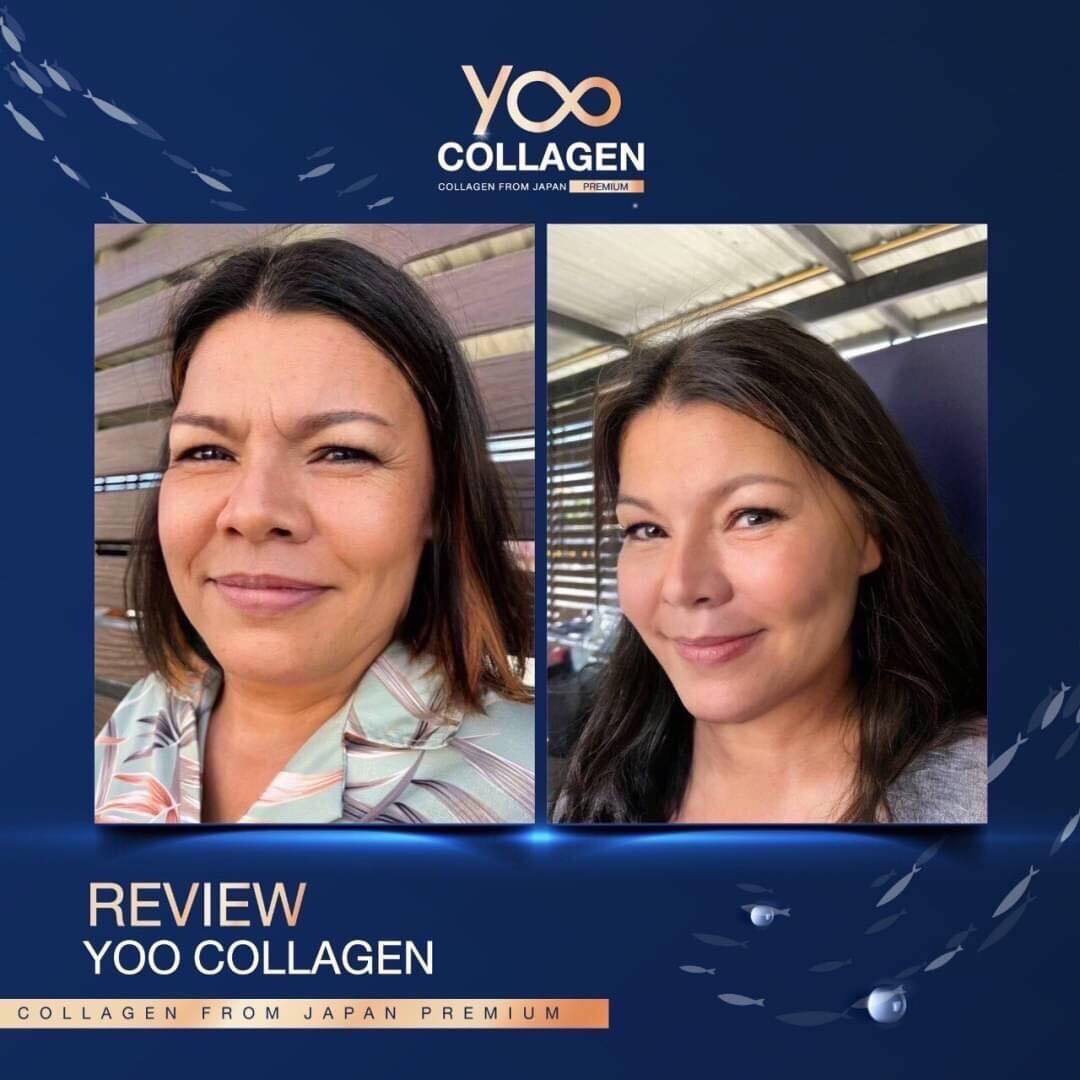 YOO COLLAGEN Tri-peptide Q10 Pure Supplement Bone Hair Strength Joints
