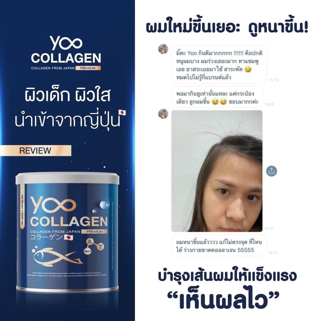 YOO COLLAGEN Tri-peptide Q10 Pure Supplement Bone Hair Strength Joints