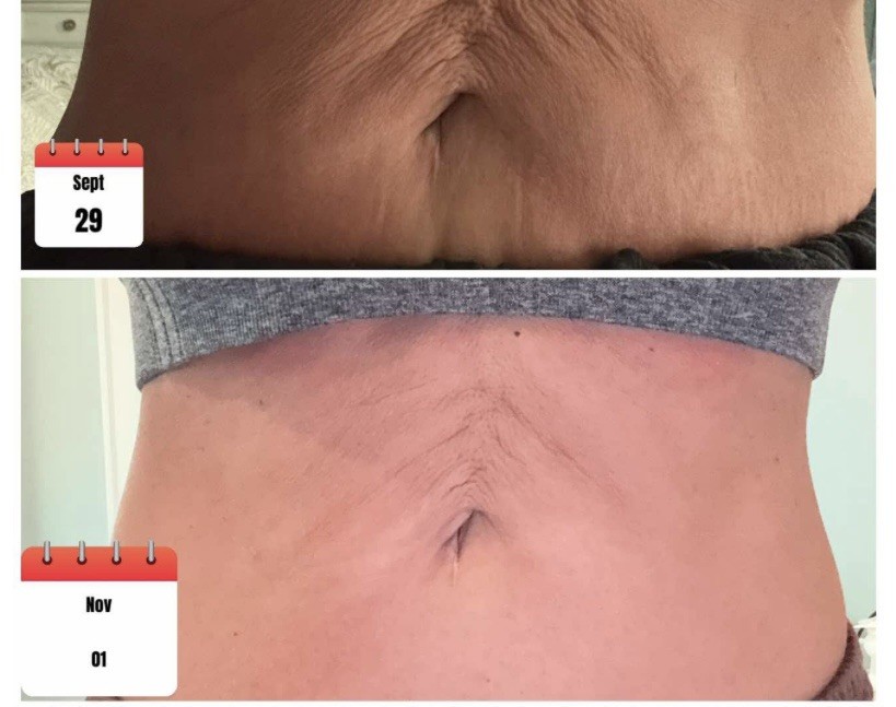 Luxe Liquid Collagen Peptides BUNDLE & SAVE.. THE BEST OF BEST 2 MONTHS WORTH!