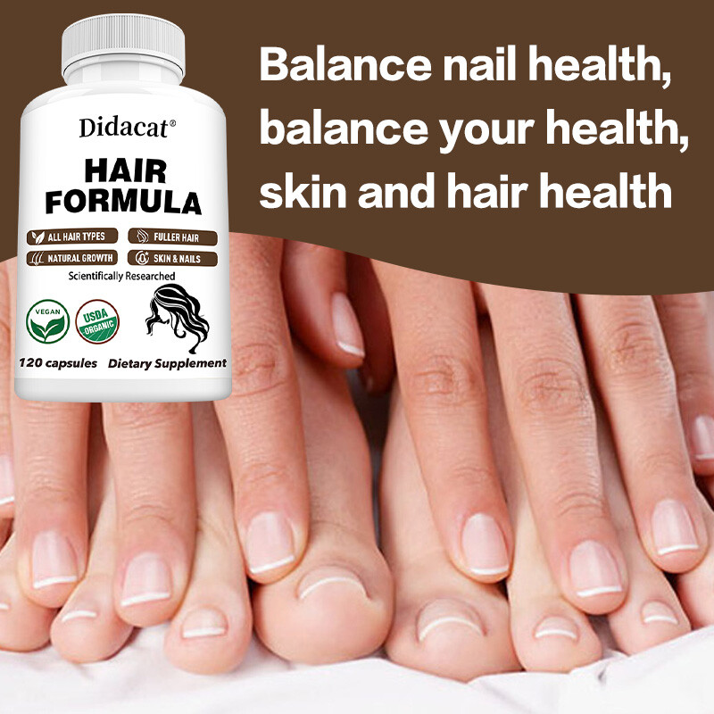 Hair Formula for Hair, Skin, & Nails Health – Biotin, Saw Palmetto, DHT Blocker