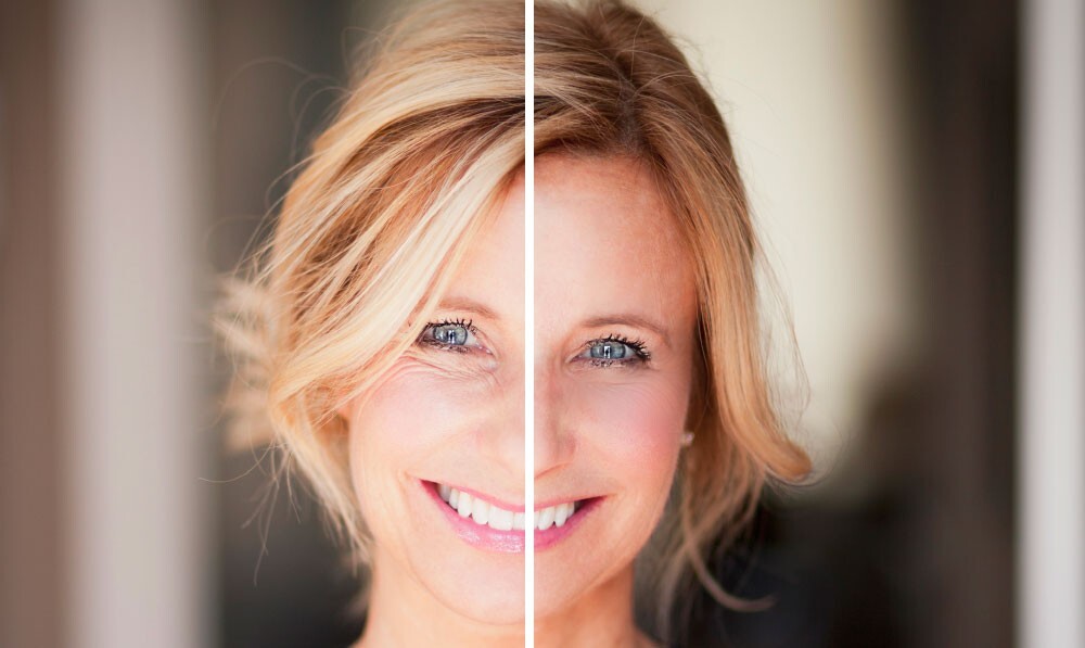 ANTI-WRINKLE COMPLEX – 60 Caps – Radiant Youth Unleashed
