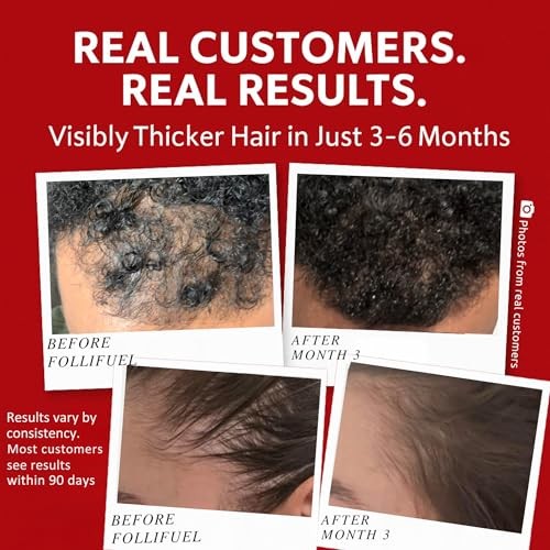 Follifuel Hair Growth Drink | 25 Vitamins Biotin Zinc