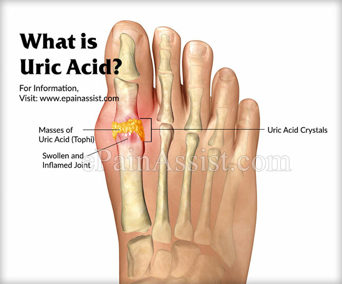 URIC ACID FORMULA – blood pressure formula – heart health for men 2 BOT