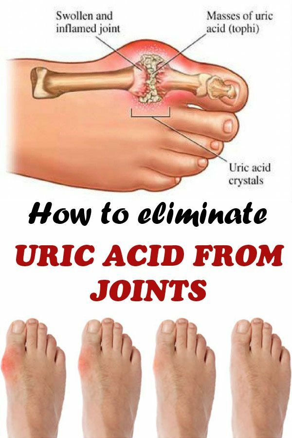 URIC ACID FORMULA – blood pressure formula – heart health for men 2 BOT