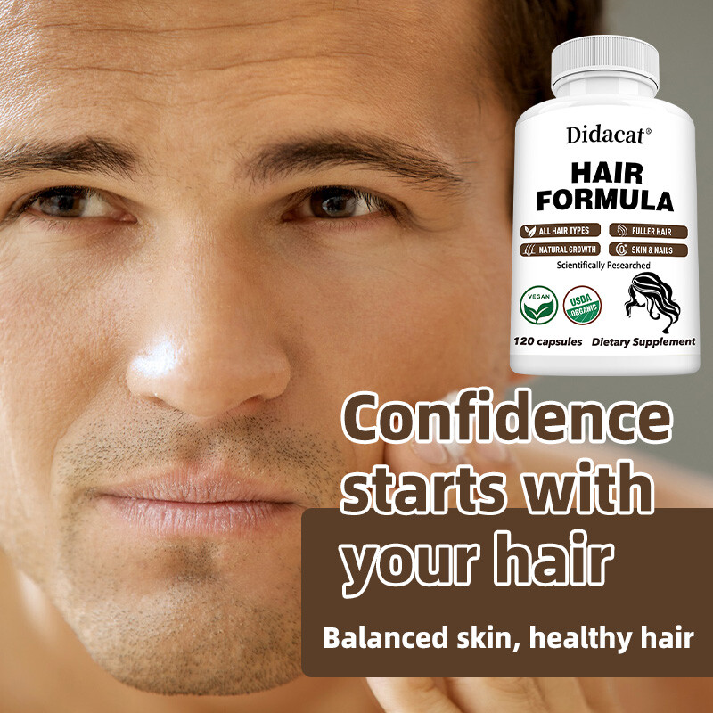Hair Formula for Hair, Skin, & Nails Health – Biotin, Saw Palmetto, DHT Blocker