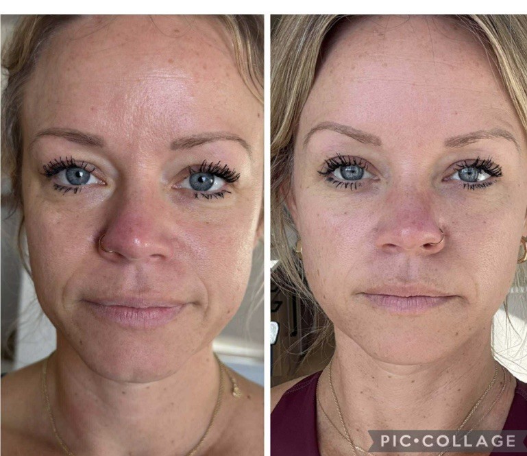 Luxe Liquid Collagen Peptides BUNDLE & SAVE.. THE BEST OF BEST 2 MONTHS WORTH!