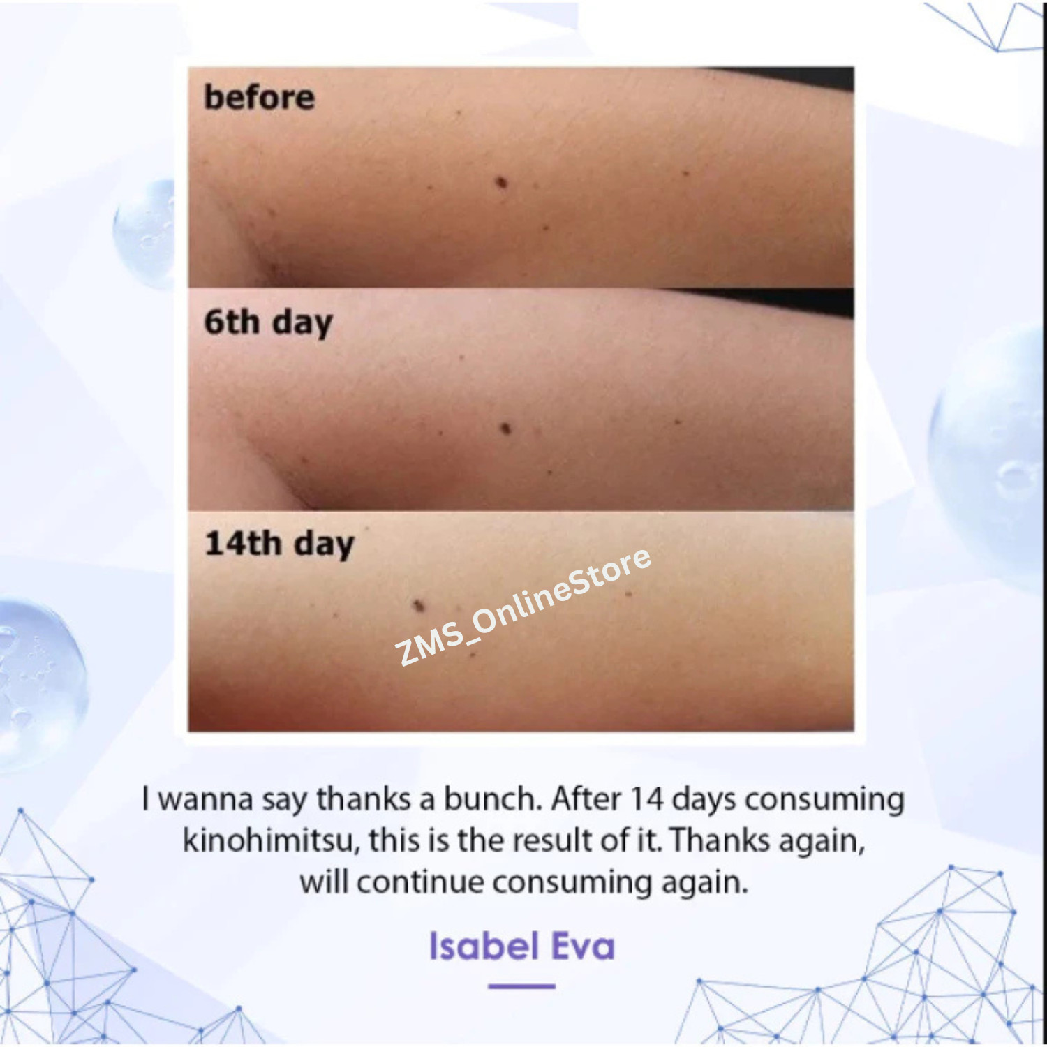 2 Boxes Kinohimitsu ProWhite for Brighten Skin Eliminate Spot – 8g x 30 sachets