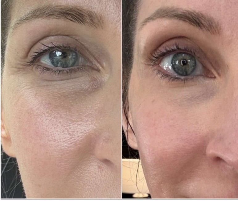 Luxe Liquid Collagen Peptides BUNDLE & SAVE.. THE BEST OF BEST 2 MONTHS WORTH!