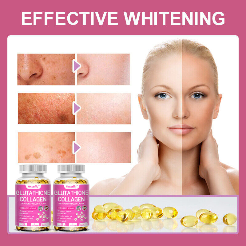 Glutathione Collagen Complex 3500 Mg Capsule Nourish The Skin Dark Spots Removal