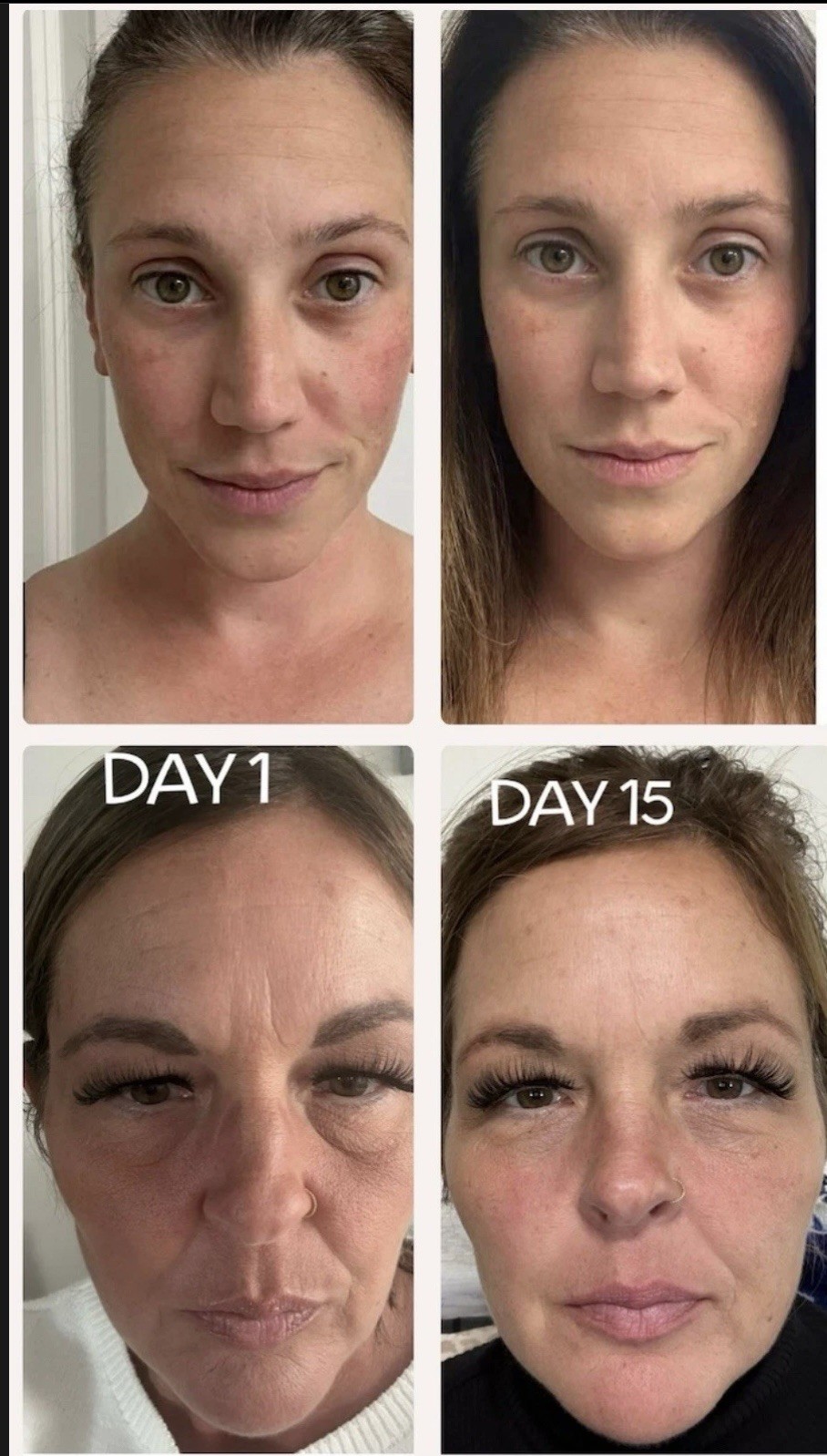 Luxe Liquid Collagen Peptides BUNDLE & SAVE.. THE BEST OF BEST 2 MONTHS WORTH!
