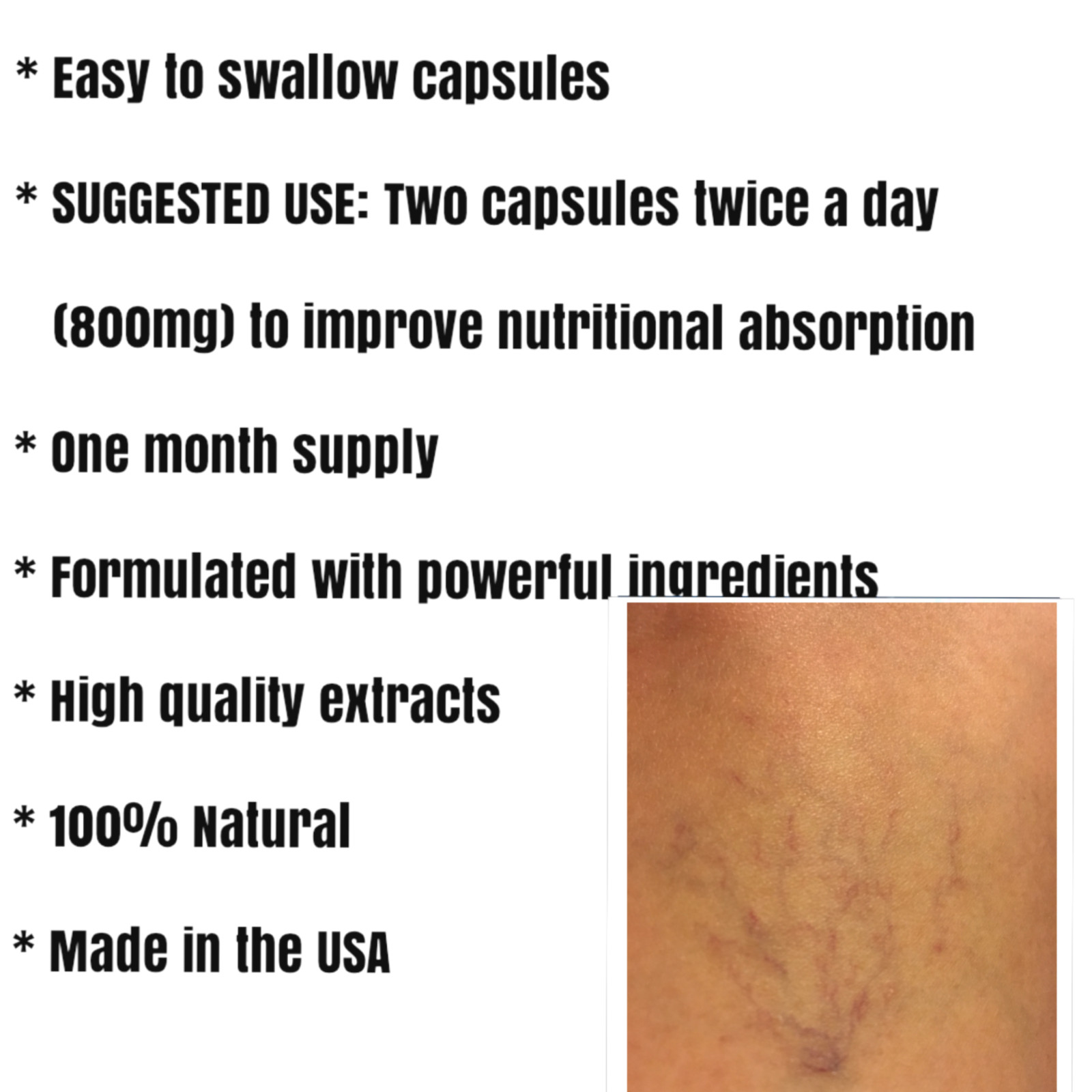 STRONG VEINS,120 capsules, BIomedical formula, Eliminate Spider Veins. Powerful.