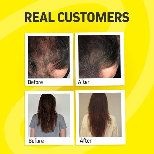 Hair Growth Vitamins for Women & Men | DHT Blocker Biotin