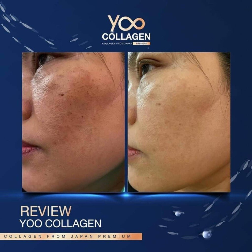 x3 YOO COLLAGEN Premium Grade 4 Elderly Old Joint Pain Nourishing Skin Soft 110g