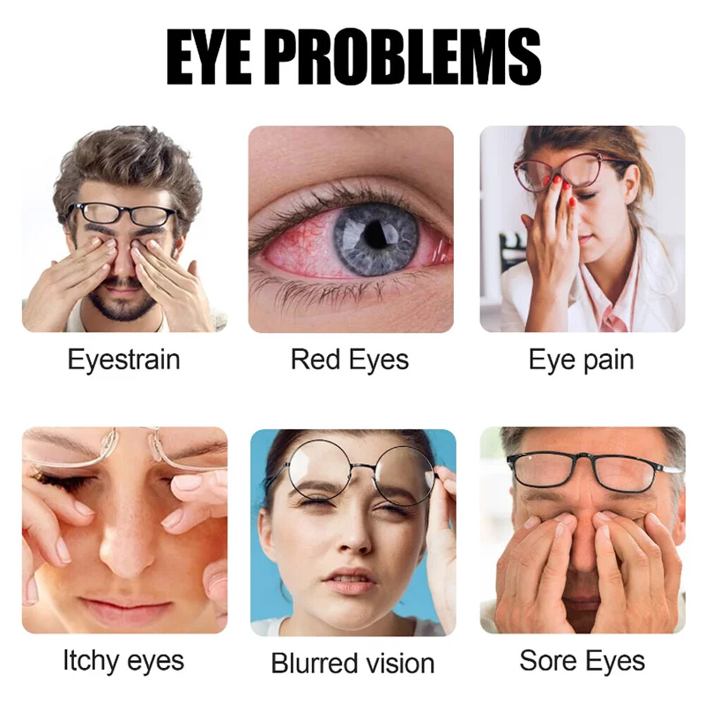 Eye Vitamin Supplement Beta-carotene Lutein Proanthocyanidin