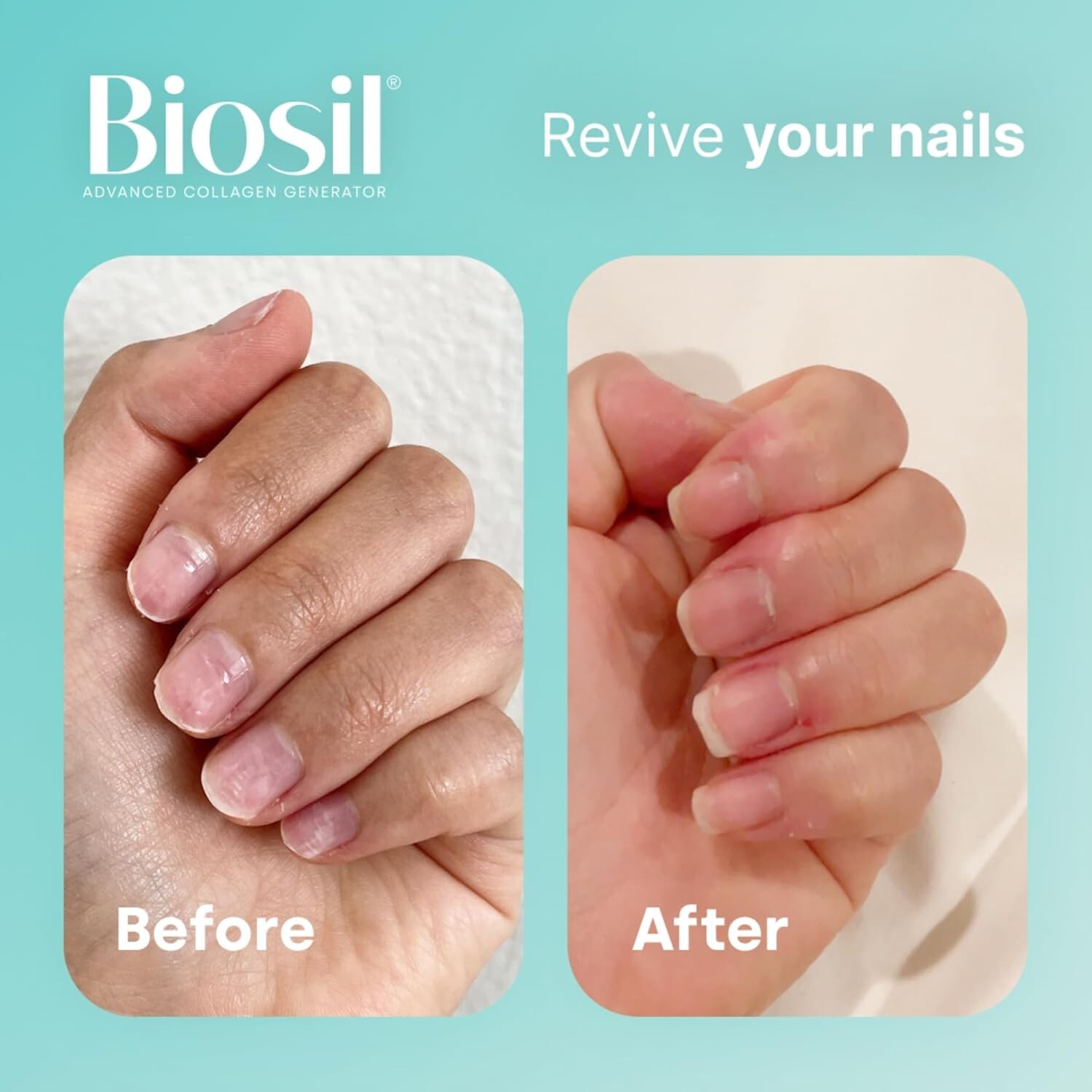 Natural Factors BioSil ch-OSA Advanced Collagen Generator 5 mg.,60 Veg Caps