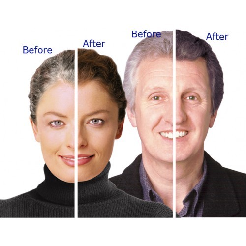 healthy hair – ANTI GRAY HAIR FORMULA – anti gray hair catalase – 2 Bottles