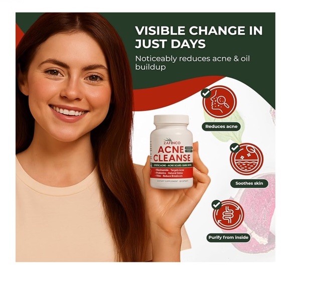 Acne Cleanse Capsules.Organic Vitex Angus Extract, Niacinamide, Biotin for Teens