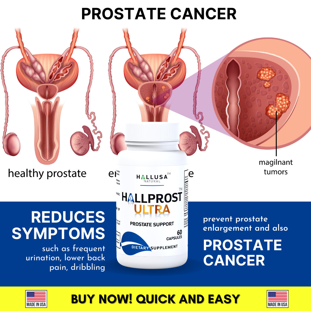 HALLPROST ULTRA – Inflamed Prostate, Prostatitis, BPH, Urinary Function, 60 Caps