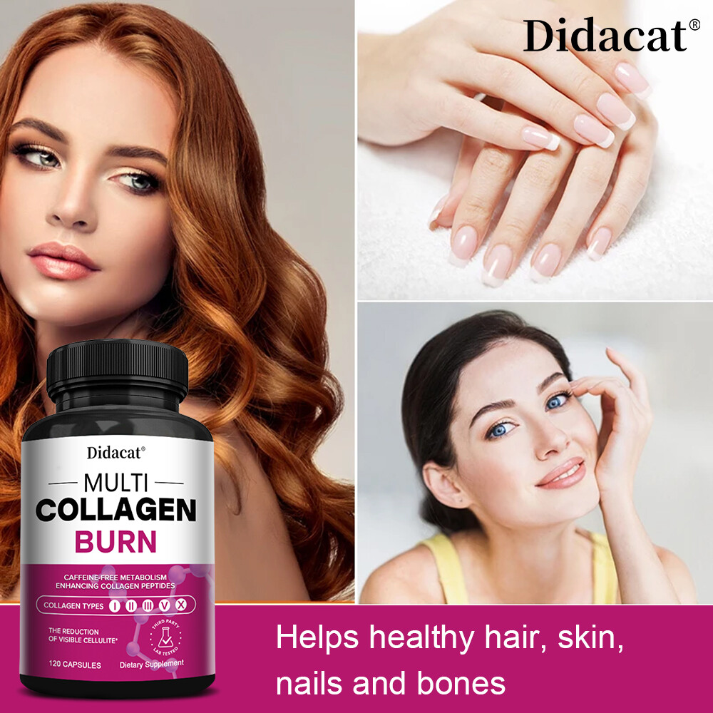 Multi Collagen Burn Capsules for Weight Loss – Hydrolyzed Collagen Peptides