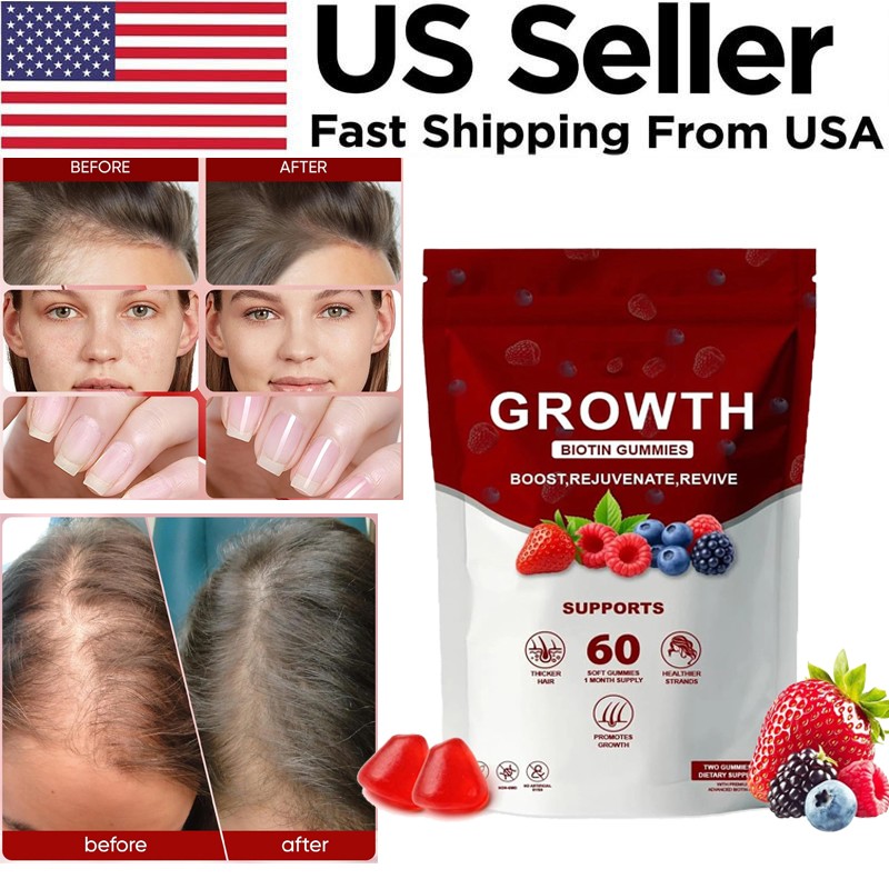 Hair Growth Gummies – Biotin Vitamins Plant Extracts, Supports Health