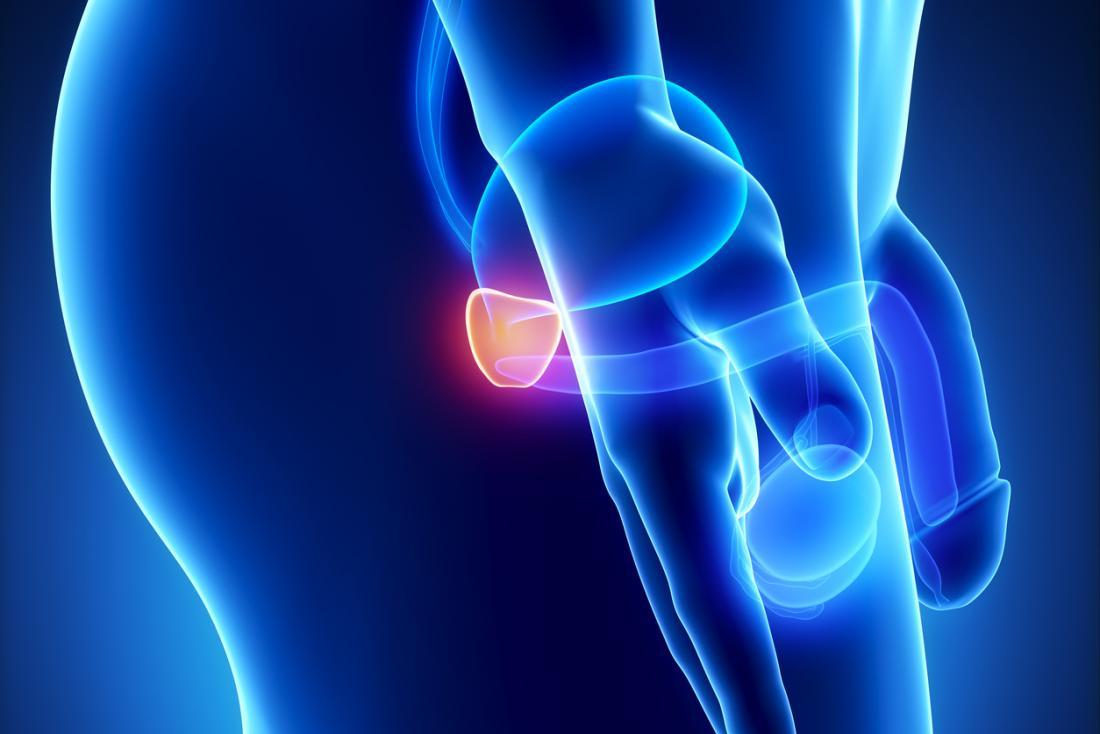 kidney cleanse – PROSTATE SUPPORT Advanced Complex -3 B- saw palmetto extract