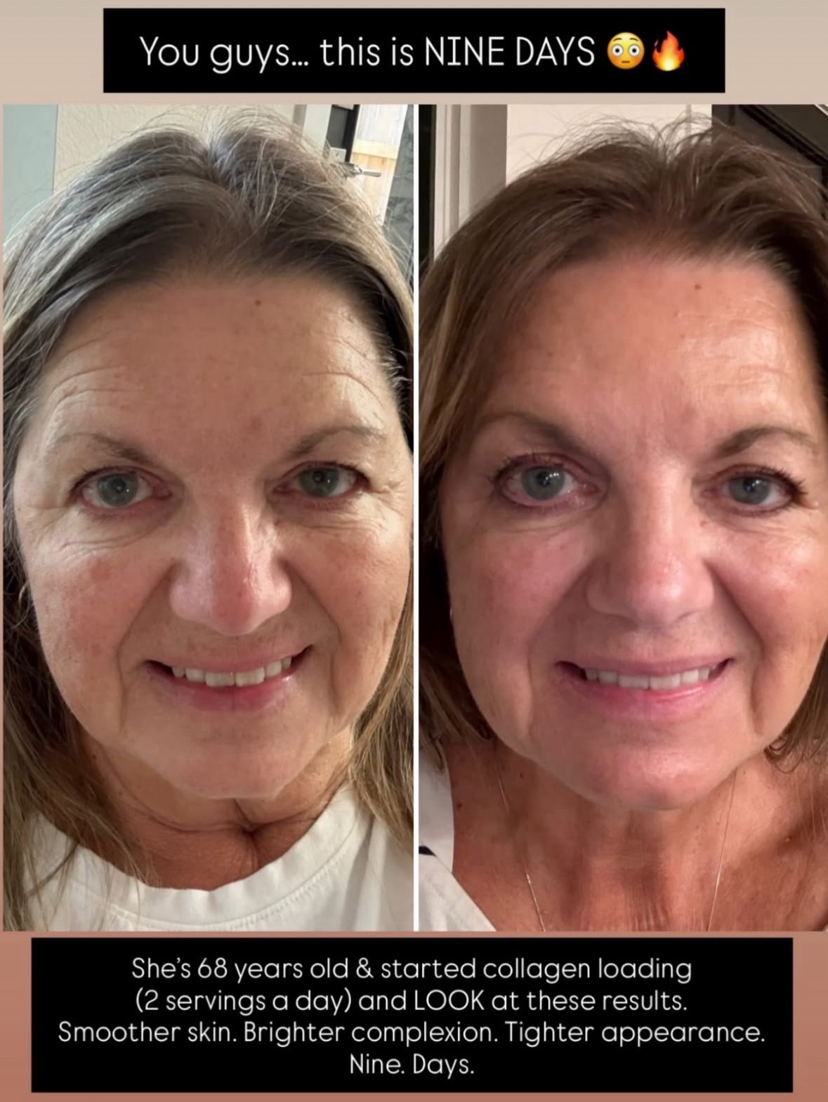 Luxe Liquid collagen Peptides