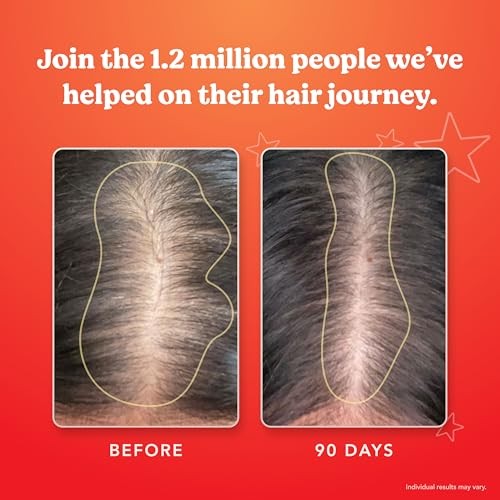 HAIRtamin Advanced Hair Growth Supplement for Women & Men