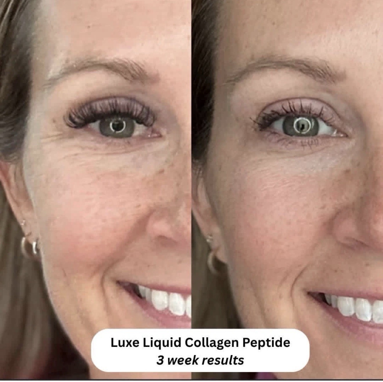 Luxe Liquid collagen Peptides