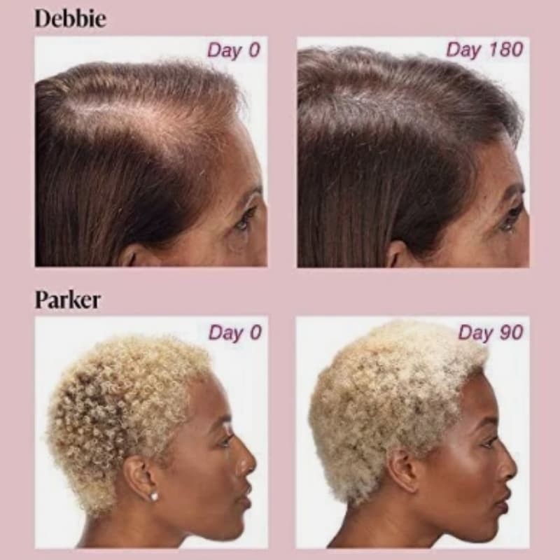Supplements 60/180 Tablets Women’s Maximum Counts Strength Hair Growth