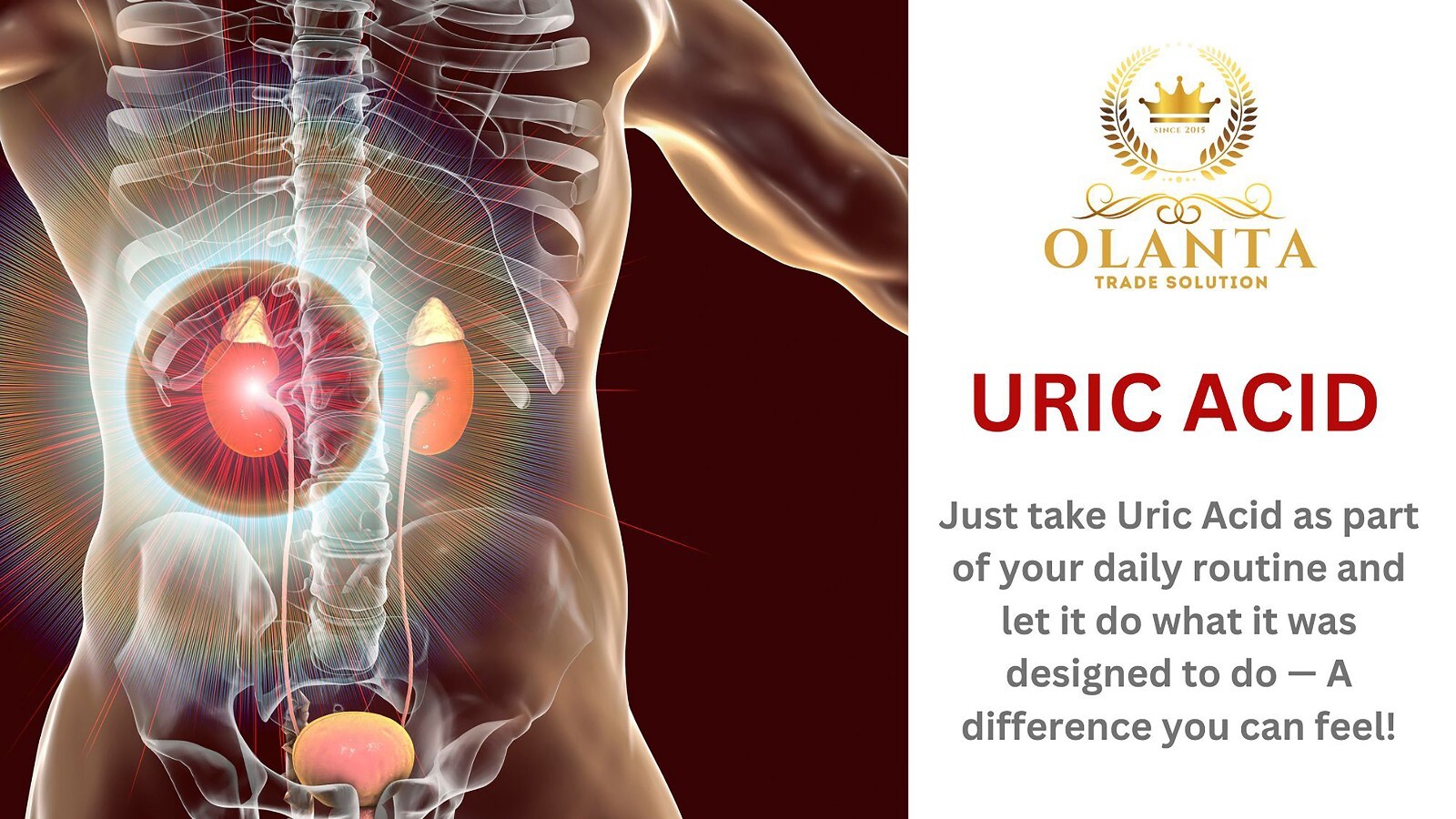 Herbal Uric Acid – URIC ACID FORMULA ADVANCED COMPLEX – joint support supplement