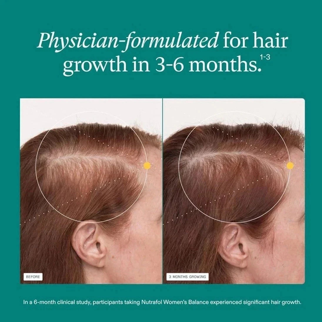 NUTRAFOLS Women’s Hair Growth Nutraceutical 120 Capsules Refill 50% OFF OFFERING