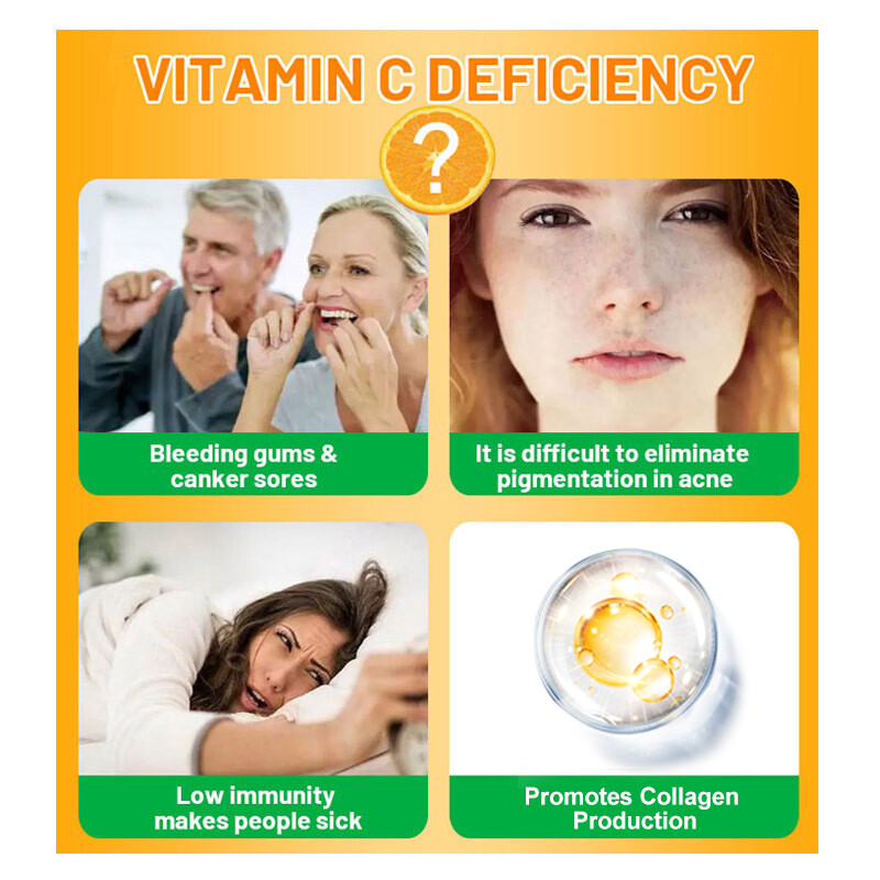 Hydrolyzed Collagen & Vitamin C 240pcs – Healthy Immune, Hair, Skin, and Nails