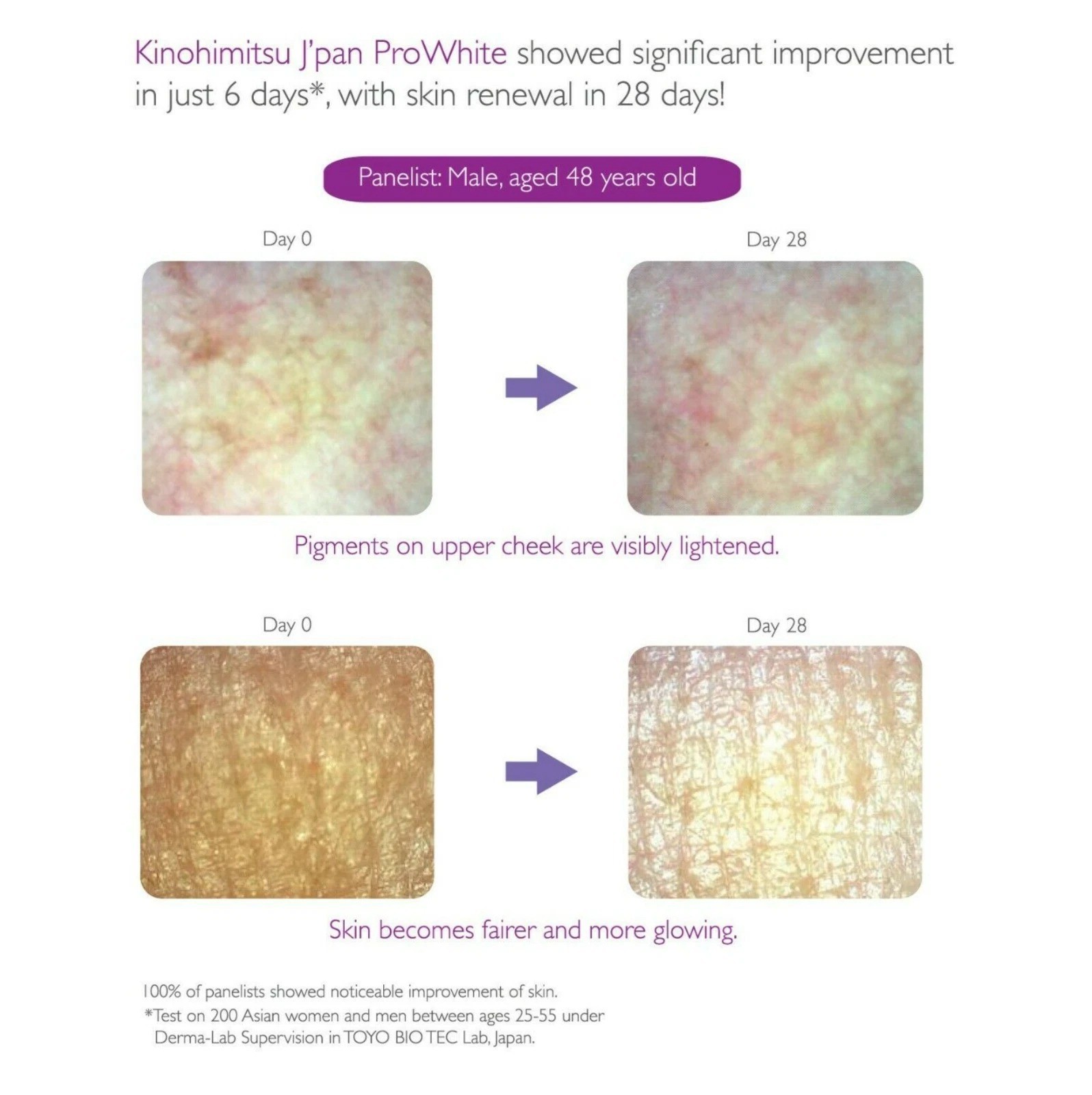 Kinohimitsu Japan Prowhite Eliminate Spots Repair Cell Boost Liver 30 Sachet DHL
