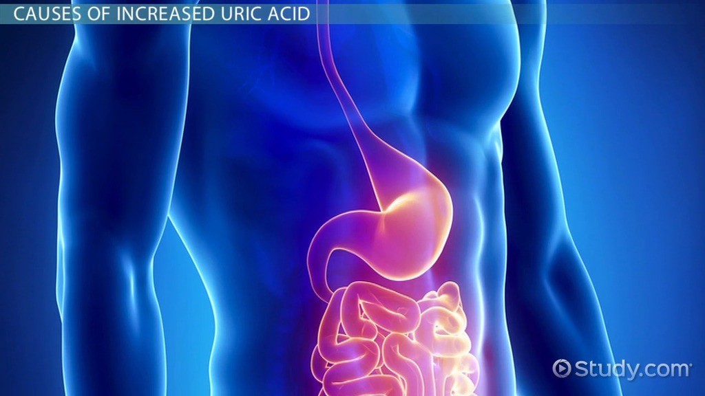antioxidant extreme – URIC ACID FORMULA – urinary flush diet – 1 Bottle